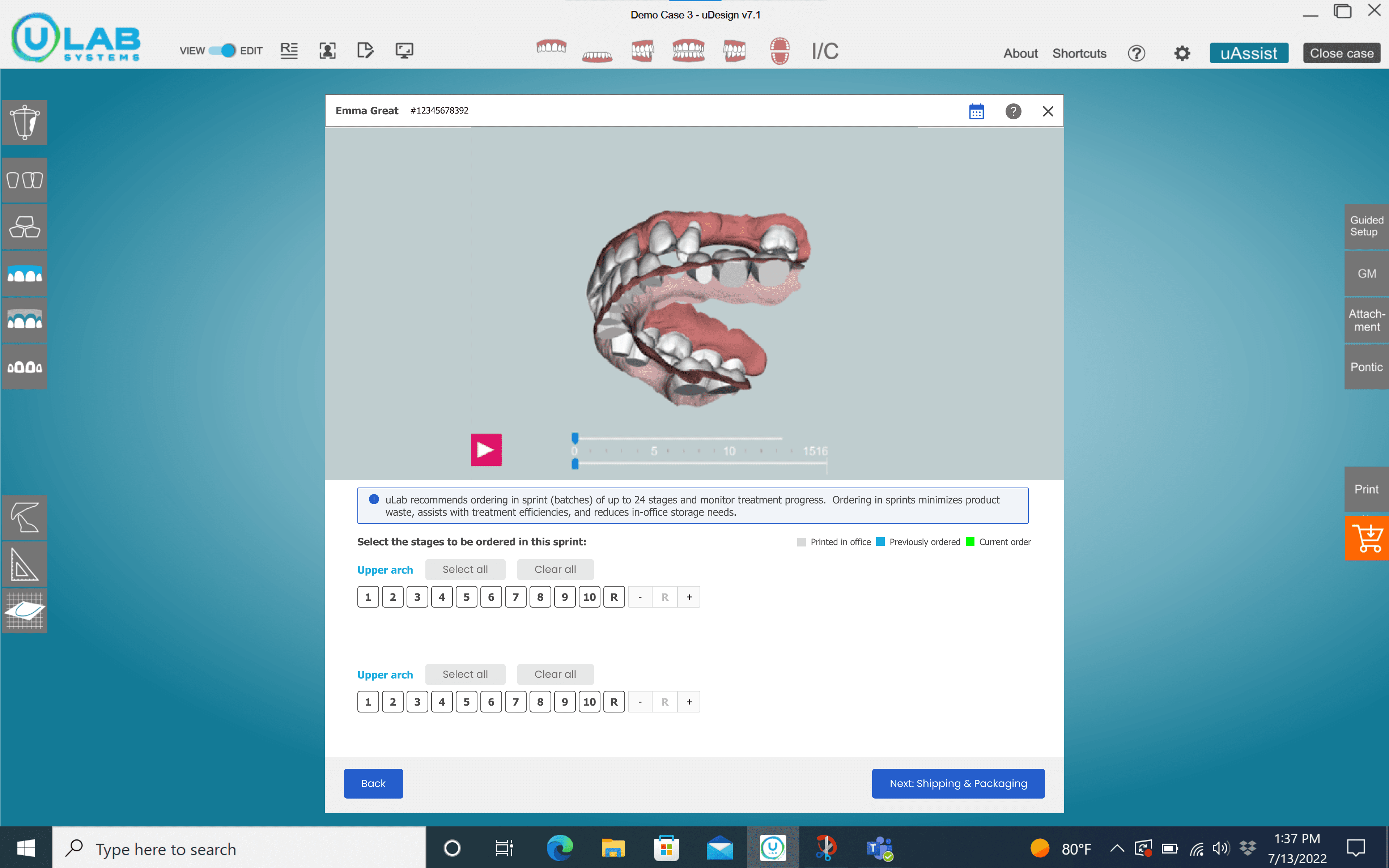Desktop checkout screen for selecting aligner stages